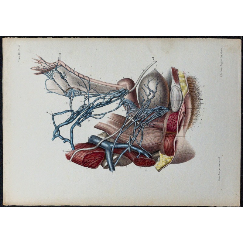 1866 - Veines pelviennes & plexus utérin 