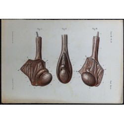 1866 - Testicule & épididyme 