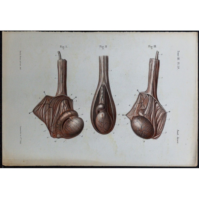 1866 - Testicule & épididyme 