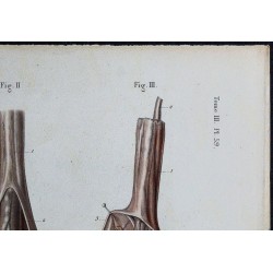 1866 - Testicule & épididyme 