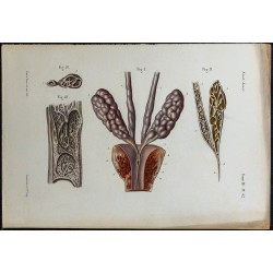 1866 - Canal déférent & ampoule terminale 