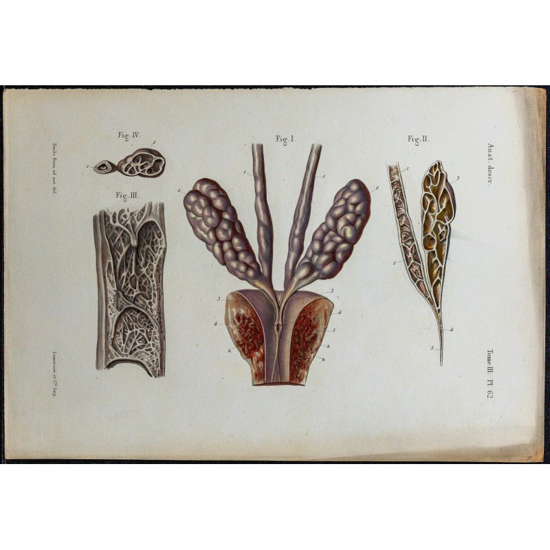 1866 - Canal déférent & ampoule terminale 
