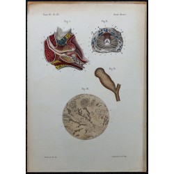1866 - Prostate & conduits éjaculateurs 