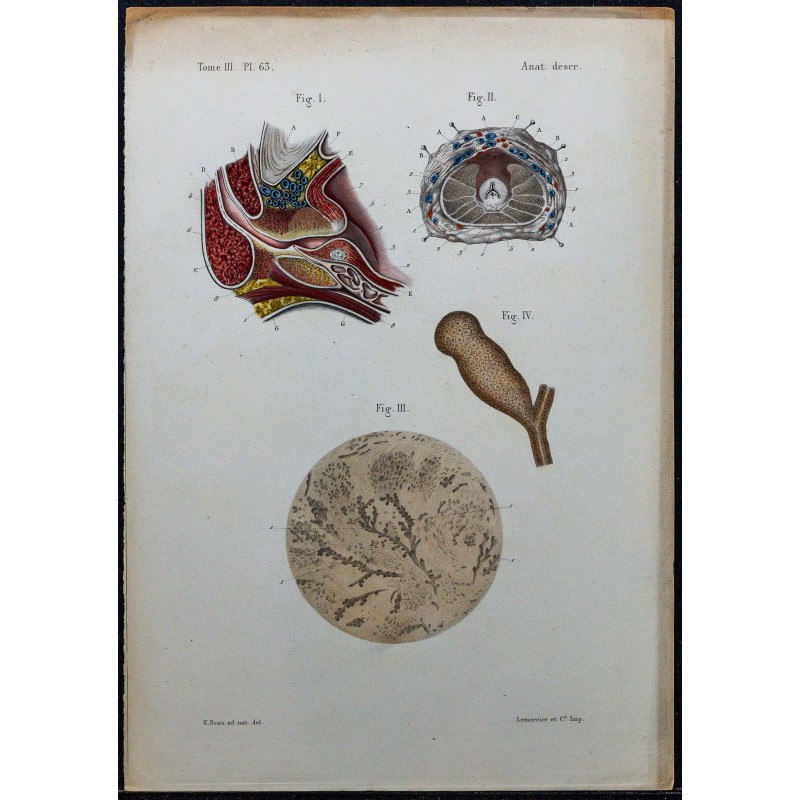1866 - Prostate & conduits éjaculateurs 