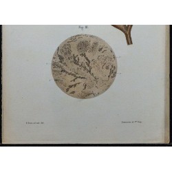 1866 - Prostate & conduits éjaculateurs 
