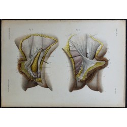 1866 - Vulve & grandes lèvres 