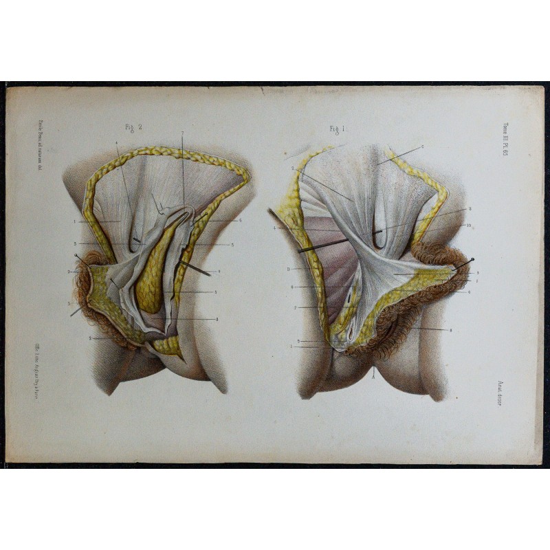 1866 - Vulve & grandes lèvres 