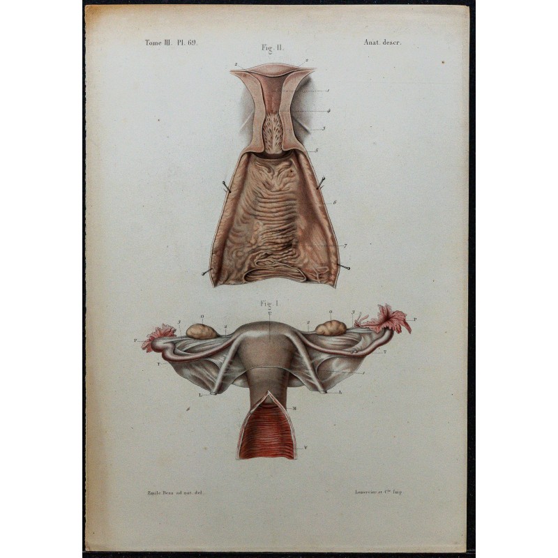 1866 - Utérus &  trompes de Fallope 