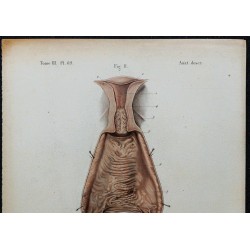 1866 - Utérus &  trompes de Fallope 