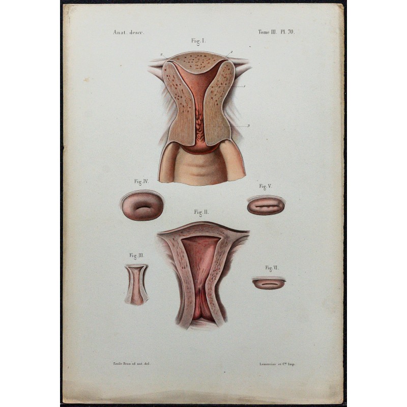 1866 - Utérus & col utérin 
