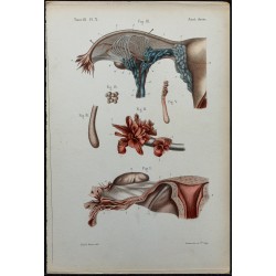 1866 - Trompe utérine & organe de Rosenmüller 