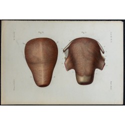 1866 - Utérus & fibres musculaires 