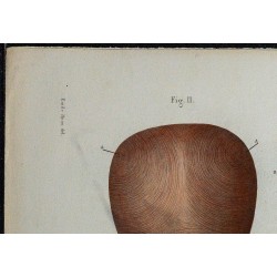 1866 - Utérus & fibres musculaires 