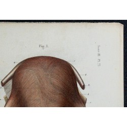 1866 - Utérus & fibres musculaires 