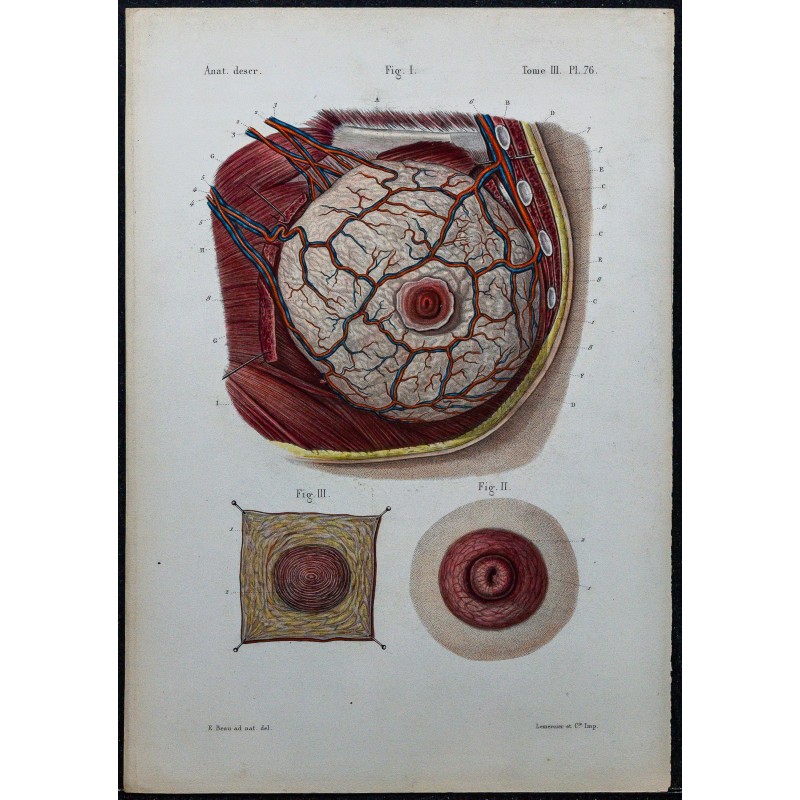 1866 - Glande mammaire, mamelon & aréole 