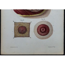 1866 - Glande mammaire, mamelon & aréole 