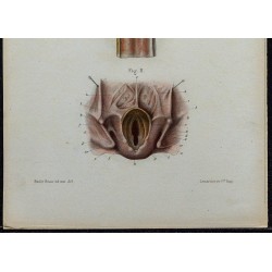 1866 - Larynx & ouverture supérieure 
