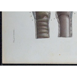 1866 - Larynx (cordes vocales & cartilages) 