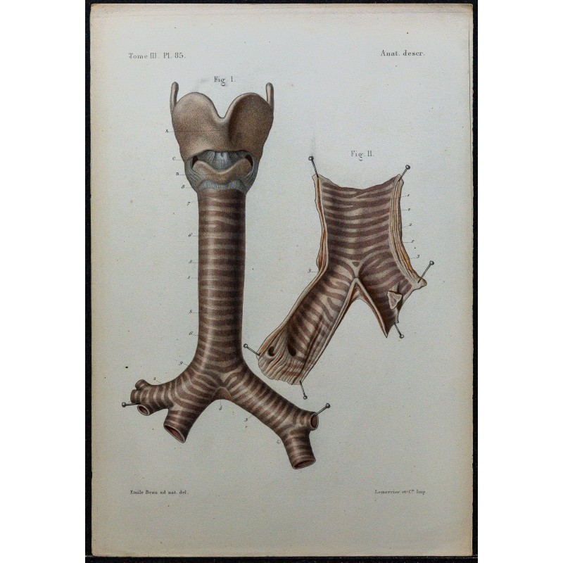 1866 - Trachée & bronches 