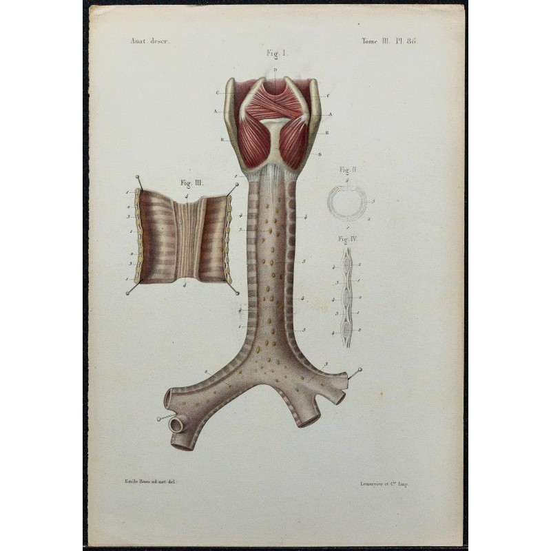 1866 - Trachée & bronches 