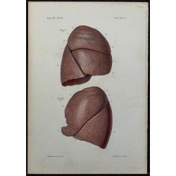 1866 - Poumons & lobes 
