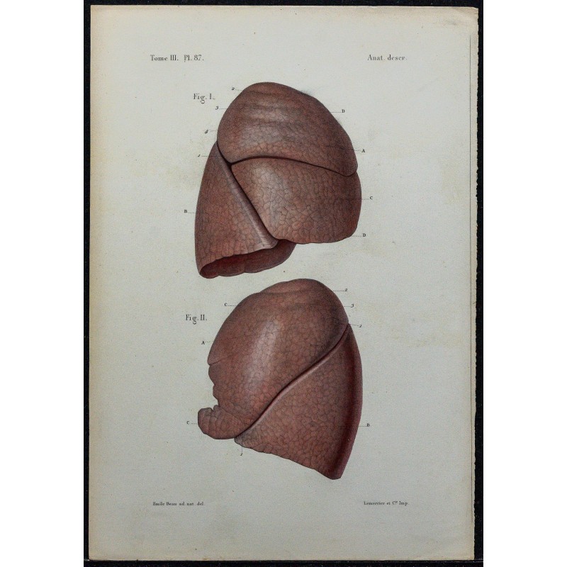 1866 - Poumons & lobes 