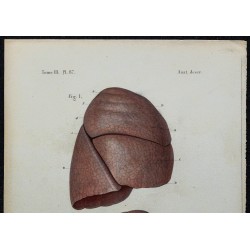 1866 - Poumons & lobes 