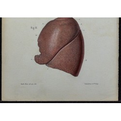 1866 - Poumons & lobes 