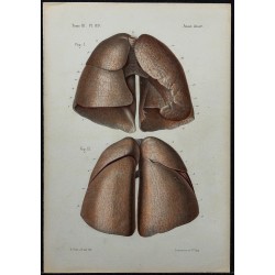 1866 - Poumons 