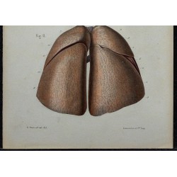 1866 - Poumons 