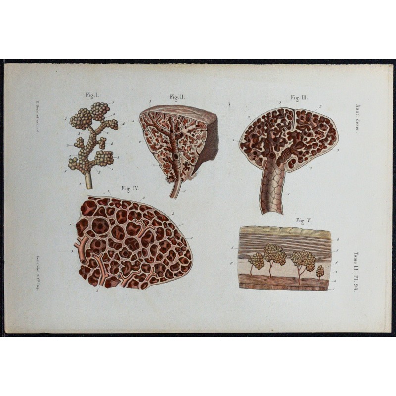 1866 - Poumon : bronchioles & alvéoles 