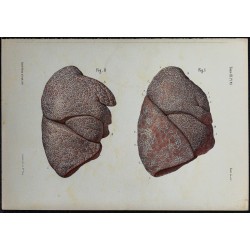 1866 - Poumons & vaisseaux lymphatiques 