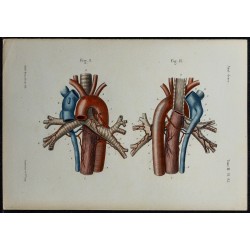 Gravure de 1866 - Bronches & vaisseaux bronchiques - 5