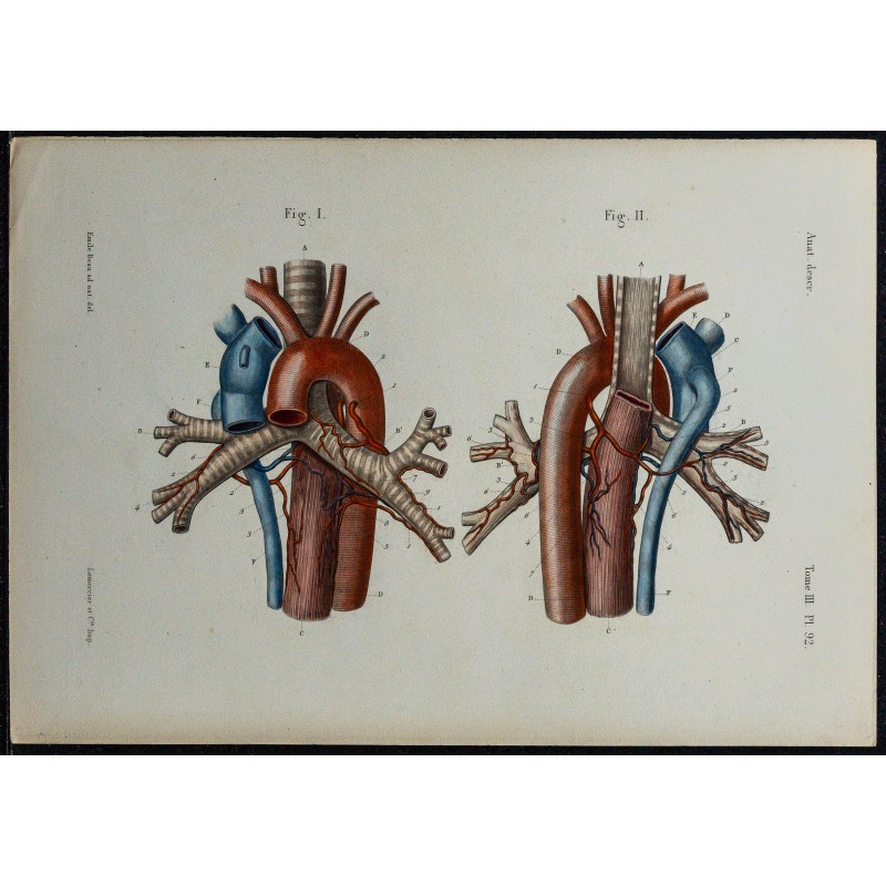 Gravure de 1866 - Bronches & vaisseaux bronchiques - 5