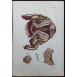 Gravure de 1866 - Structure de l’utérus - 1