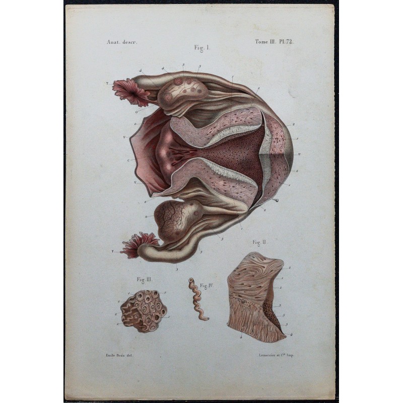 Gravure de 1866 - Structure de l’utérus - 1